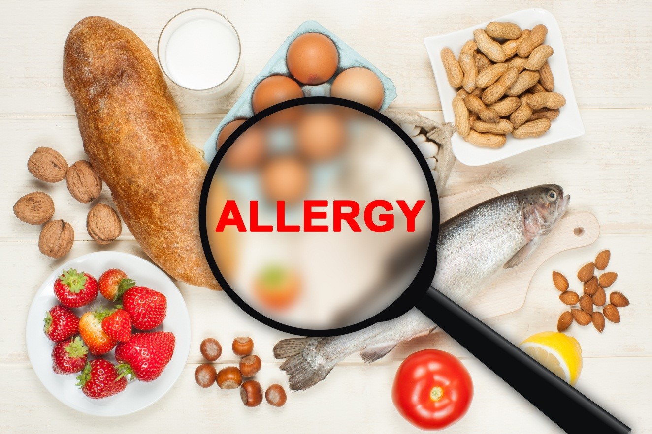 Bagaimana Cara Mengatasi Alergi Makanan pada Anak?